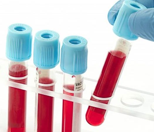 Kan Testleri Nedir?