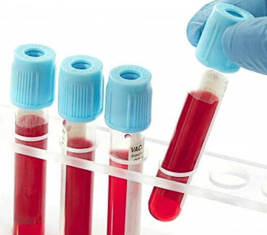 Kan Testleri Nedir?